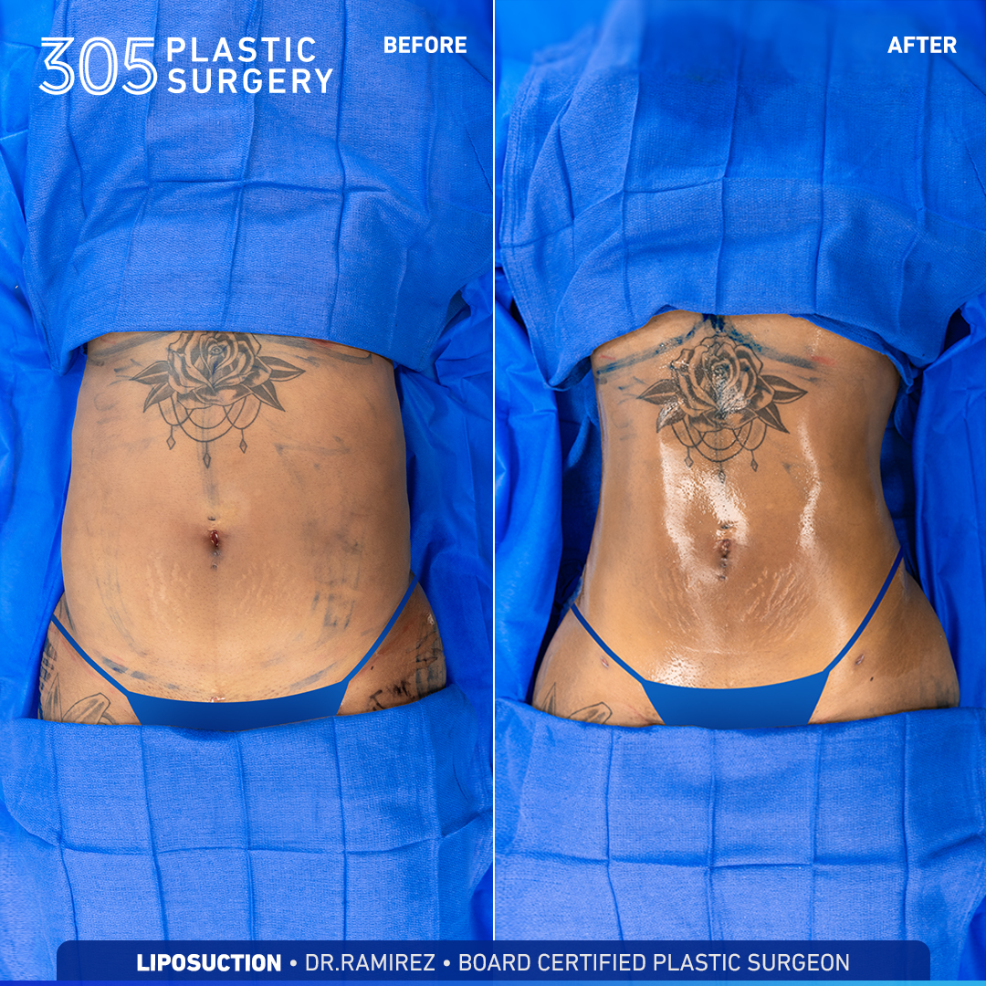 305 plastic surgery 305 plastic surgery