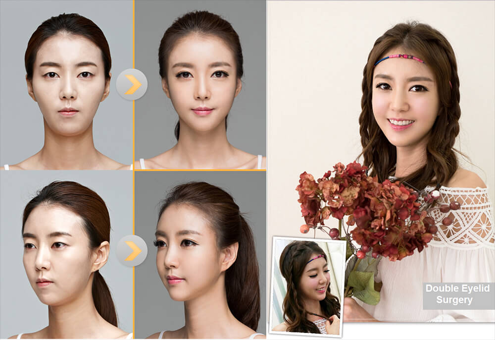 korean surgery korean surgery