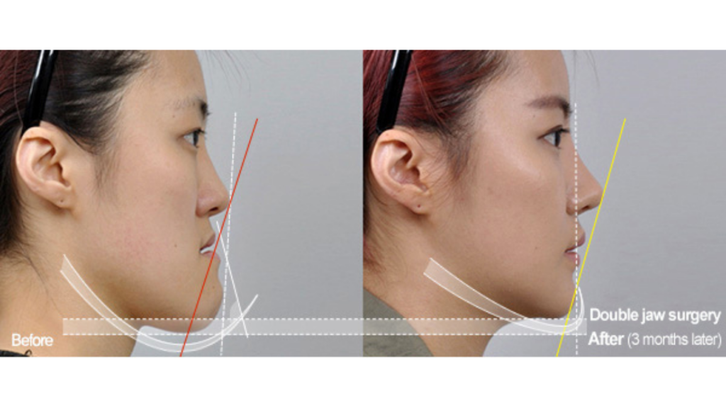 korean surgery korean surgery
