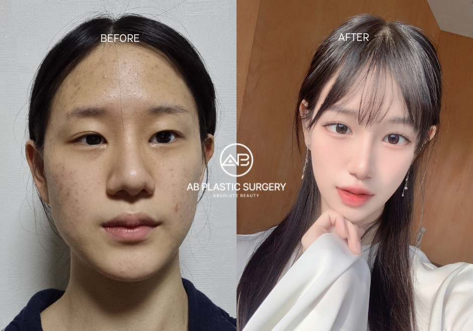 korean surgery korean surgery