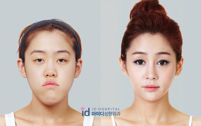 korean surgery korean surgery
