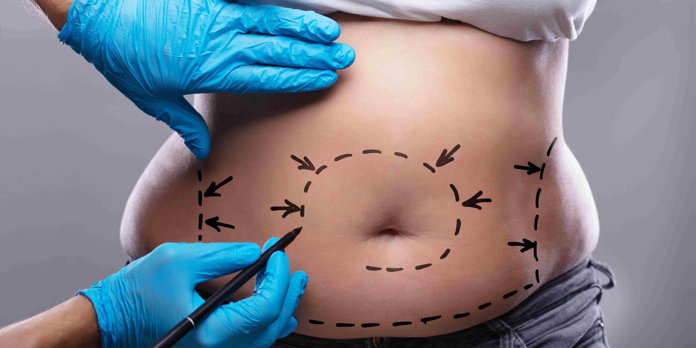 abdominal plastic surgery abdominal plastic surgery