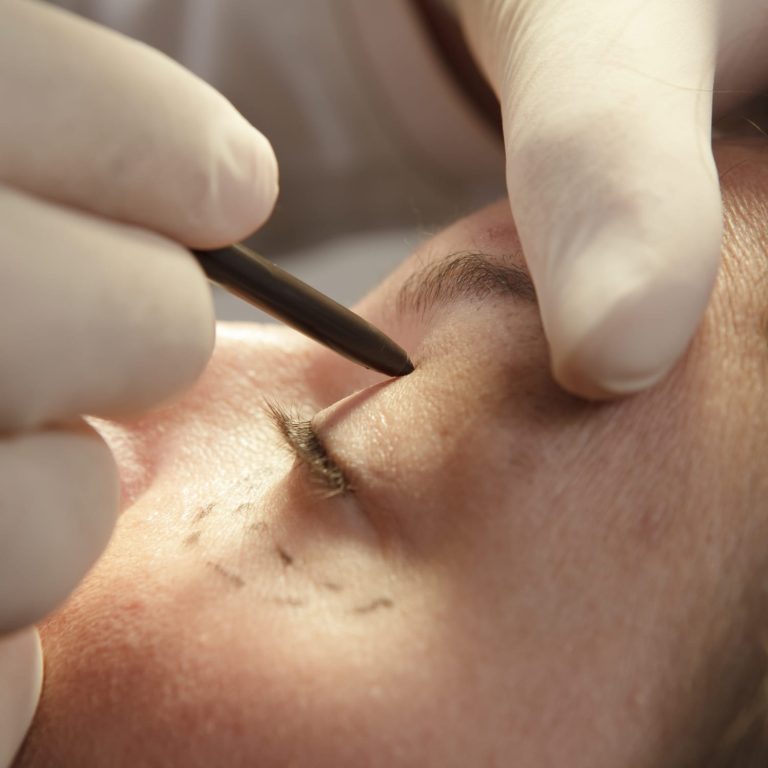 Aesthetic Plastic Surgery: Enhancing your natural beauty