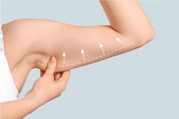 arm lift cost arm lift cost