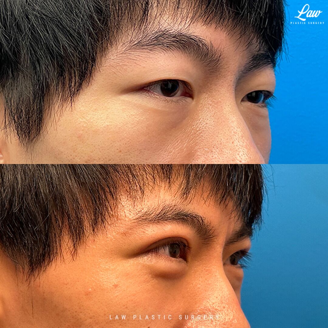 asian plastic surgery asian plastic surgery
