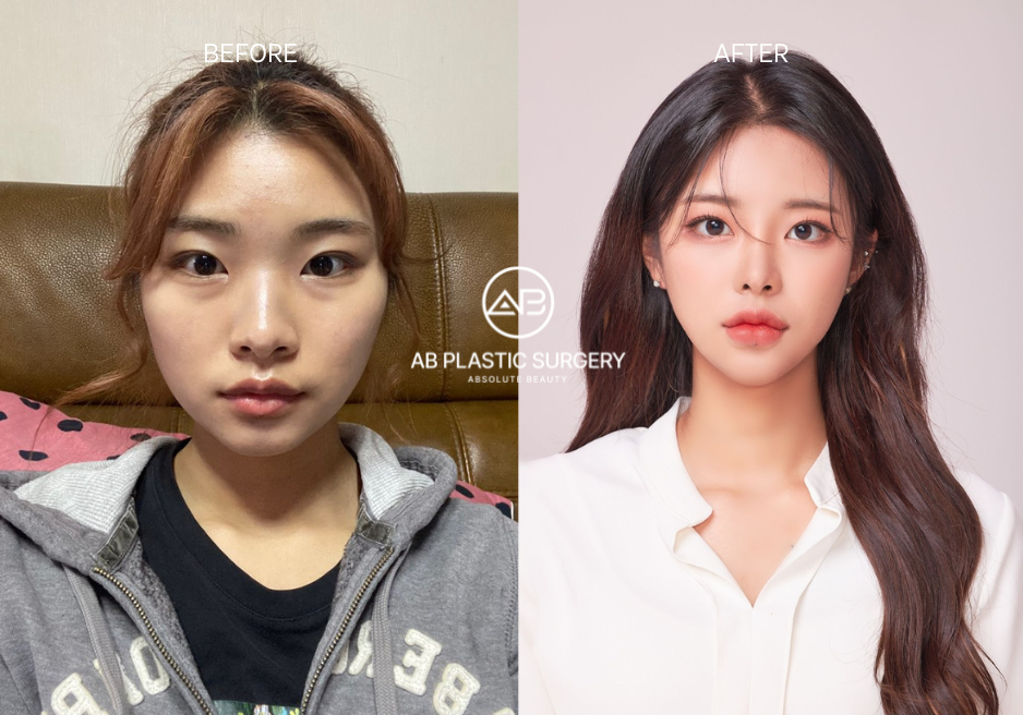 beauty surgery beauty surgery
