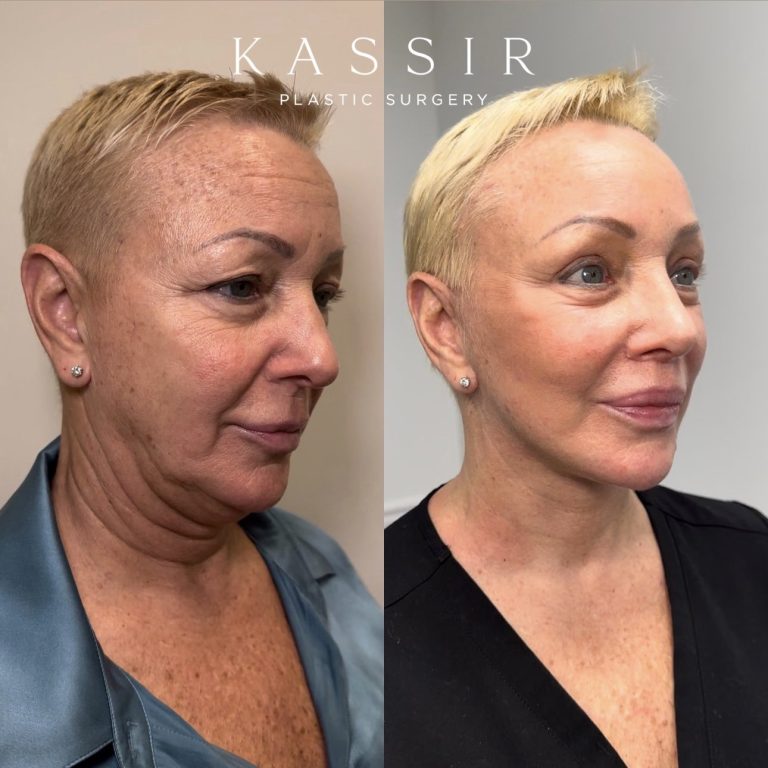 Best cosmetic surgeon: How to find the top experts in the field