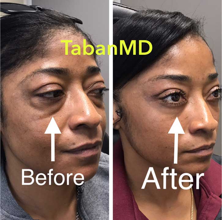 best eye cosmetic surgeon