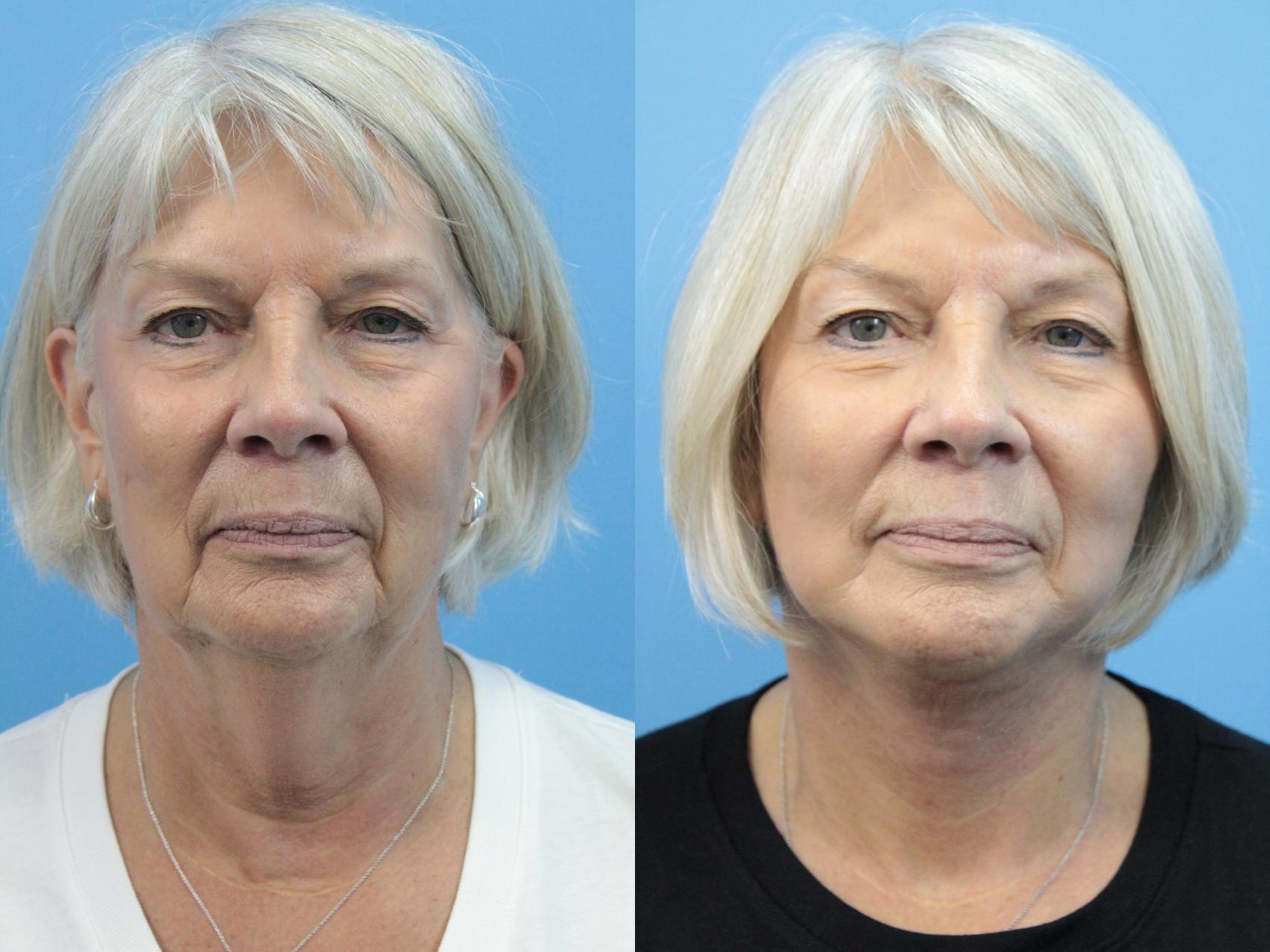 best facial cosmetic surgeon best facial cosmetic surgeon