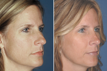 best plastic surgery best plastic surgery