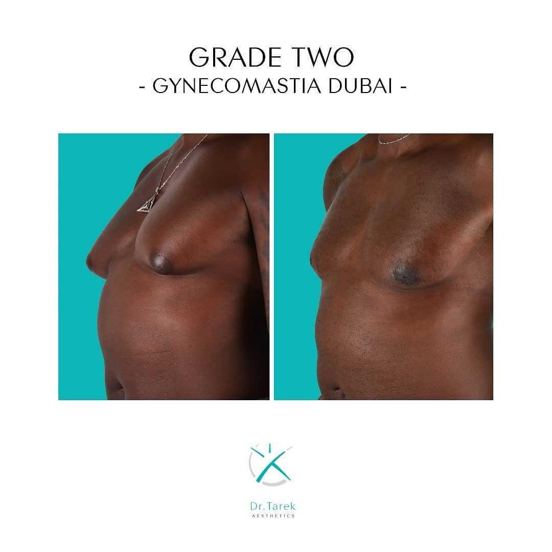 body plastic surgery