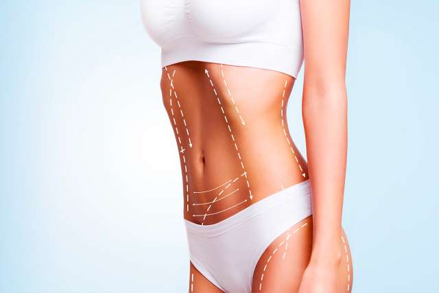body plastic surgery