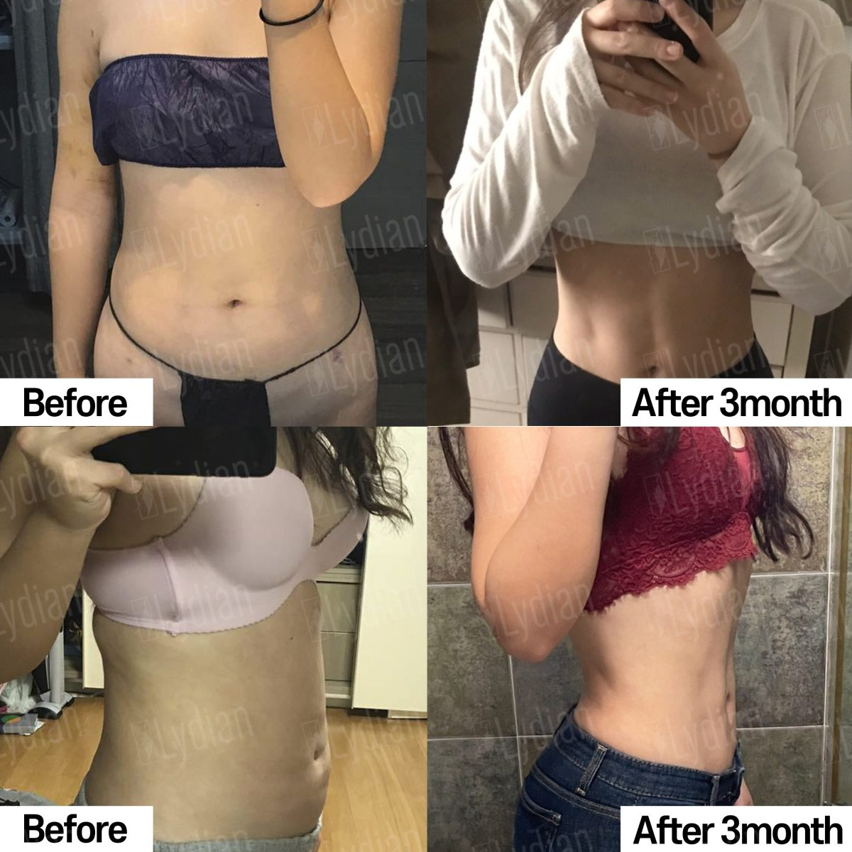 body plastic surgery