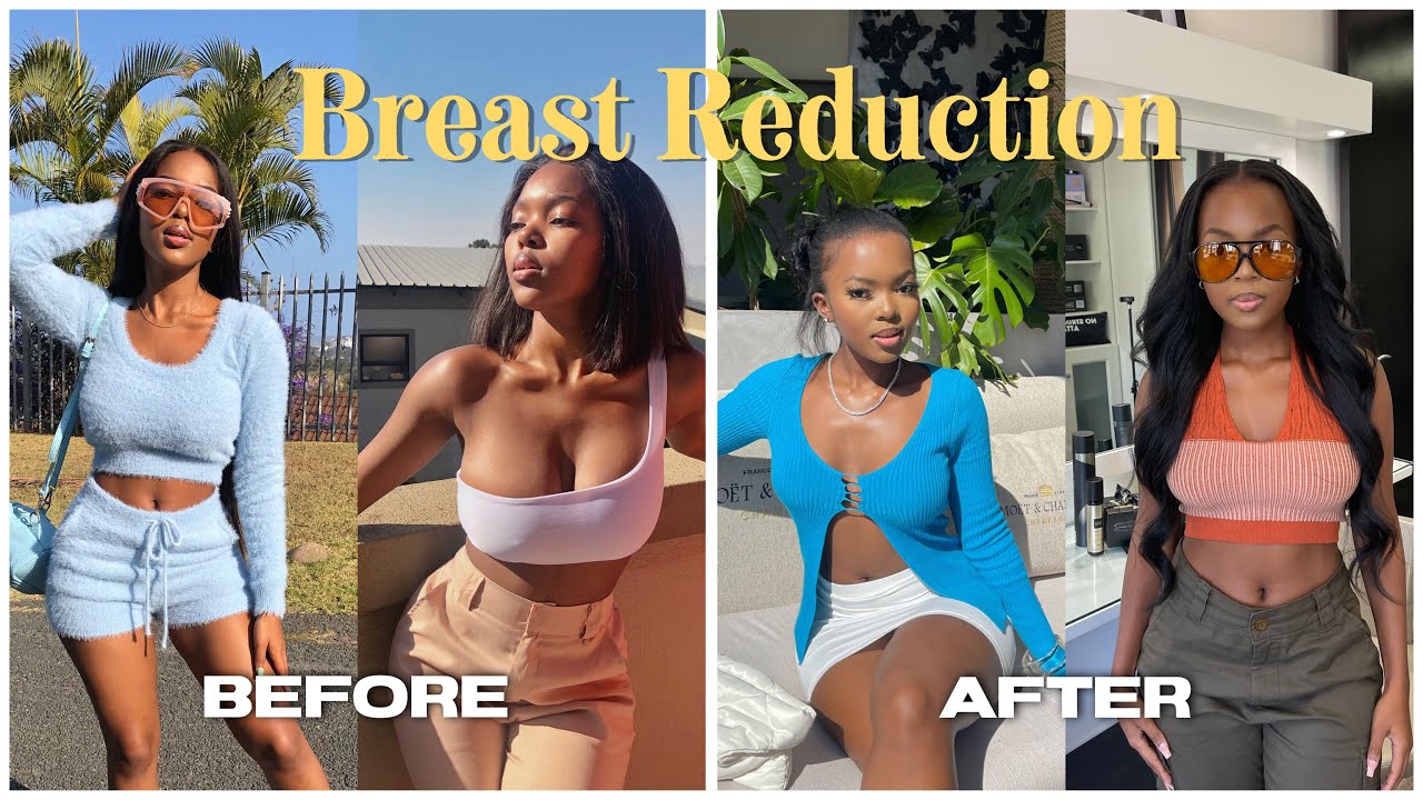 boob reduction price boob reduction price