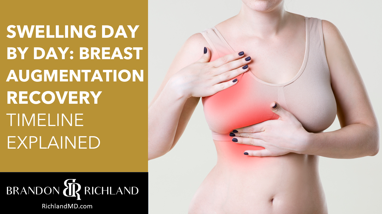 breast aug breast aug