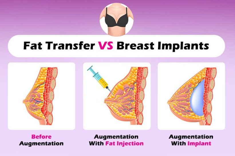 breast injections breast injections