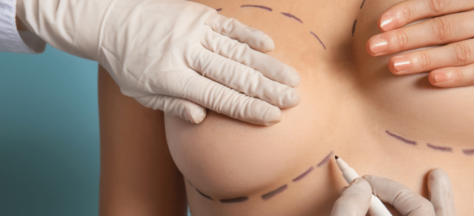 breast lift cost