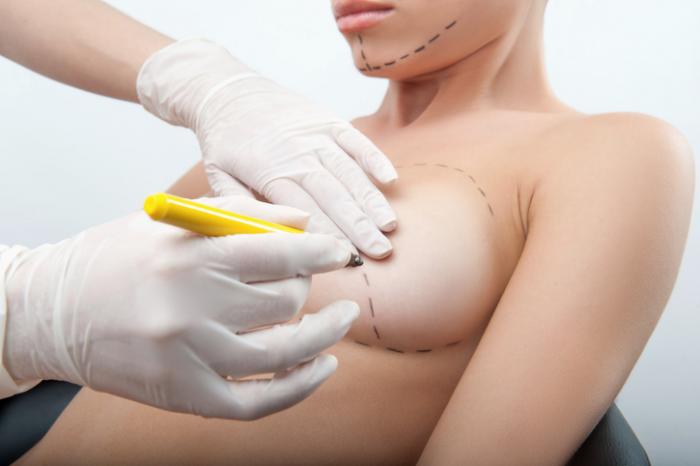 breast operation breast operation