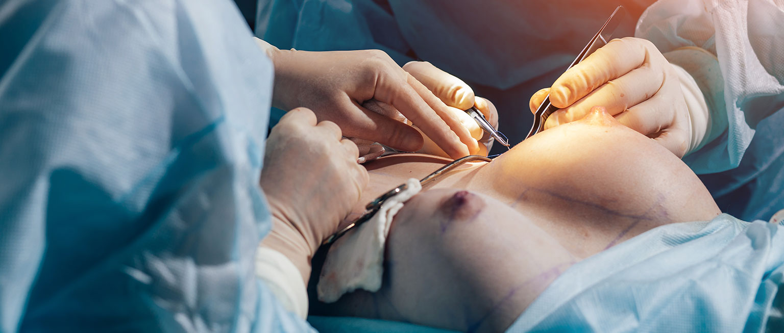 breast operation breast operation