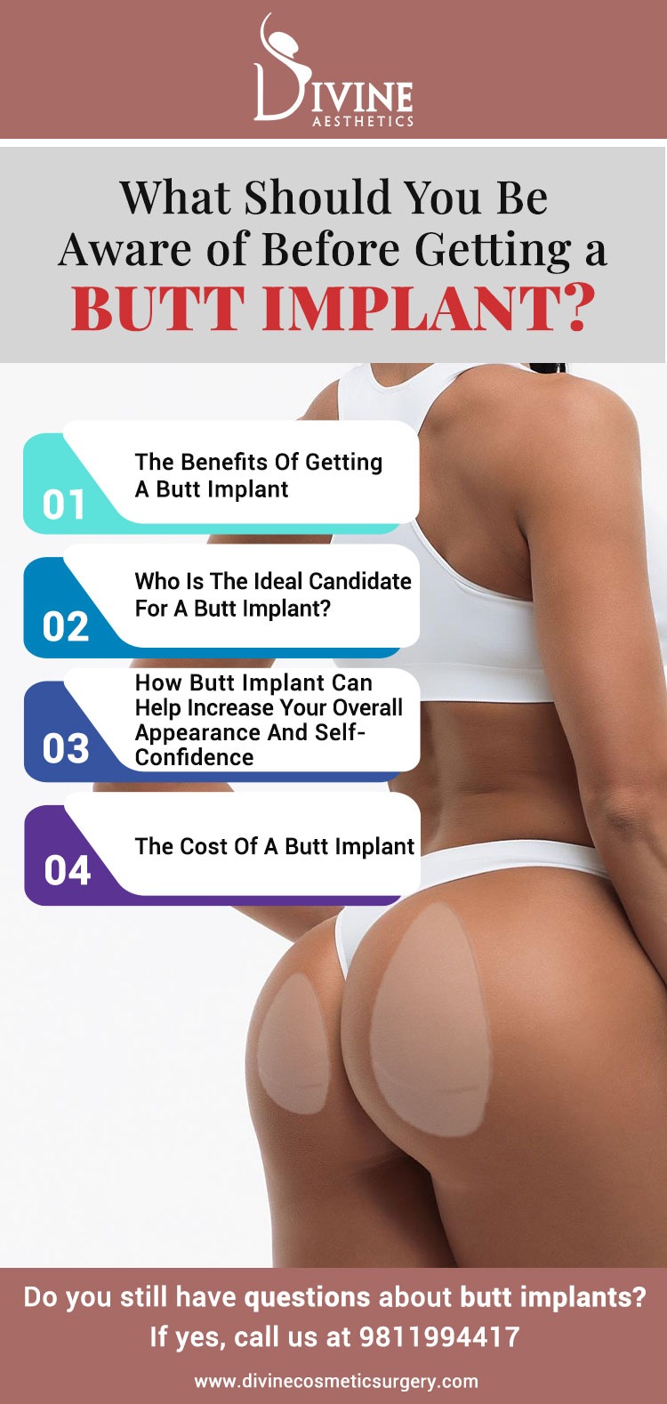 butt implant