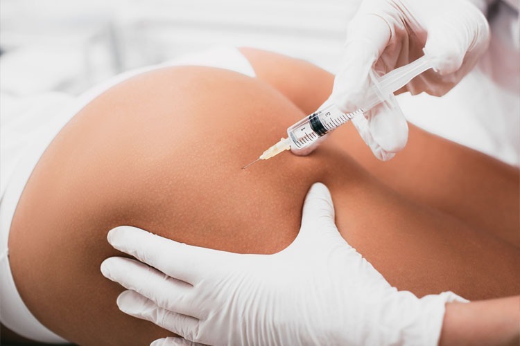 butt injections cost butt injections cost