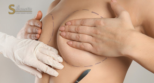 C cup breast implants: Finding the perfect size for your frame