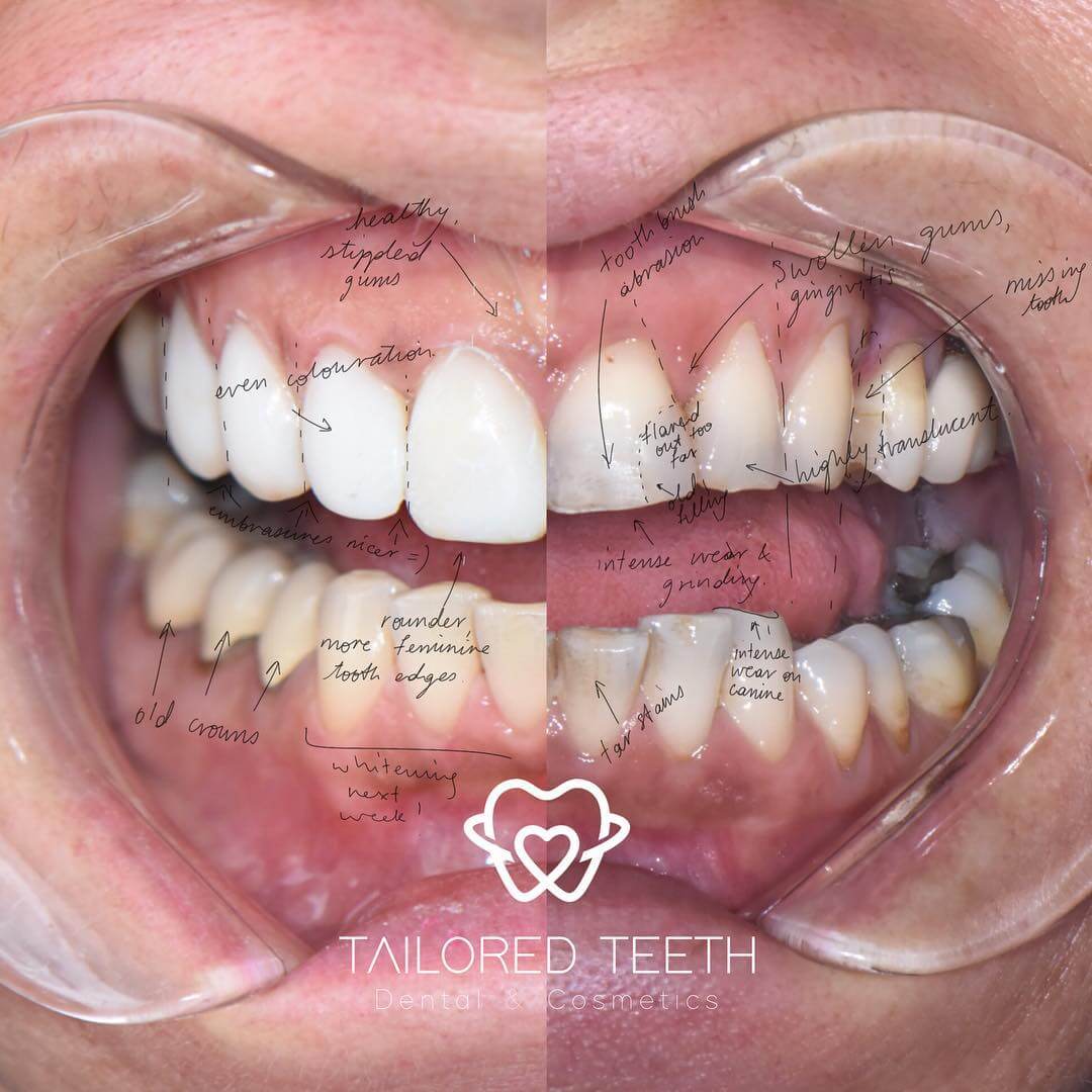 cosmetic procedures cosmetic procedures
