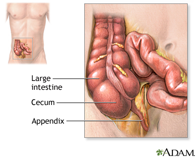 surgical removal of the appendix surgical removal of the appendix