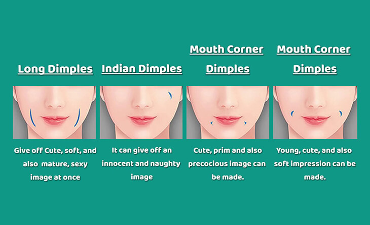 dimples surgery dimples surgery