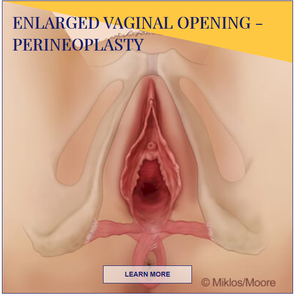vaginal plastic surgery vaginal plastic surgery