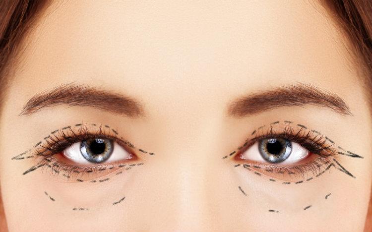 eye plastic surgery
