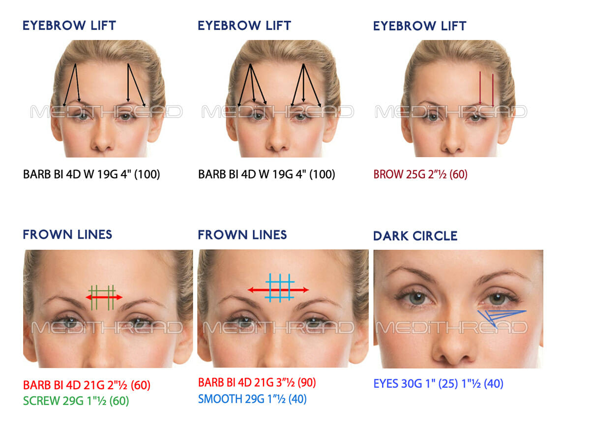 eyebrow lift eyebrow lift