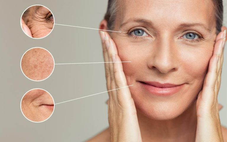 Face lift treatment: Rejuvenate and tighten your appearance