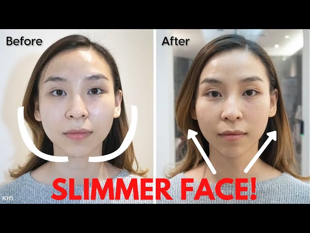 face slimming surgery face slimming surgery