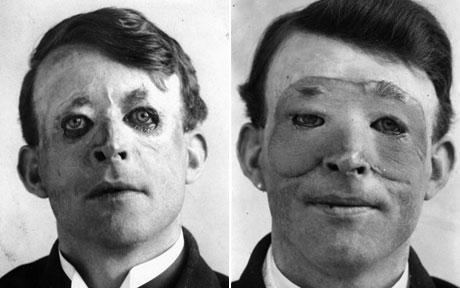 facial reconstruction surgery facial reconstruction surgery