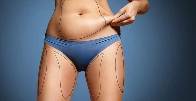 fat transfer from stomach to buttocks cost