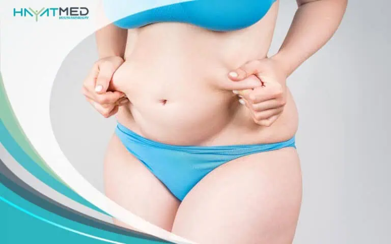 fdl tummy tuck