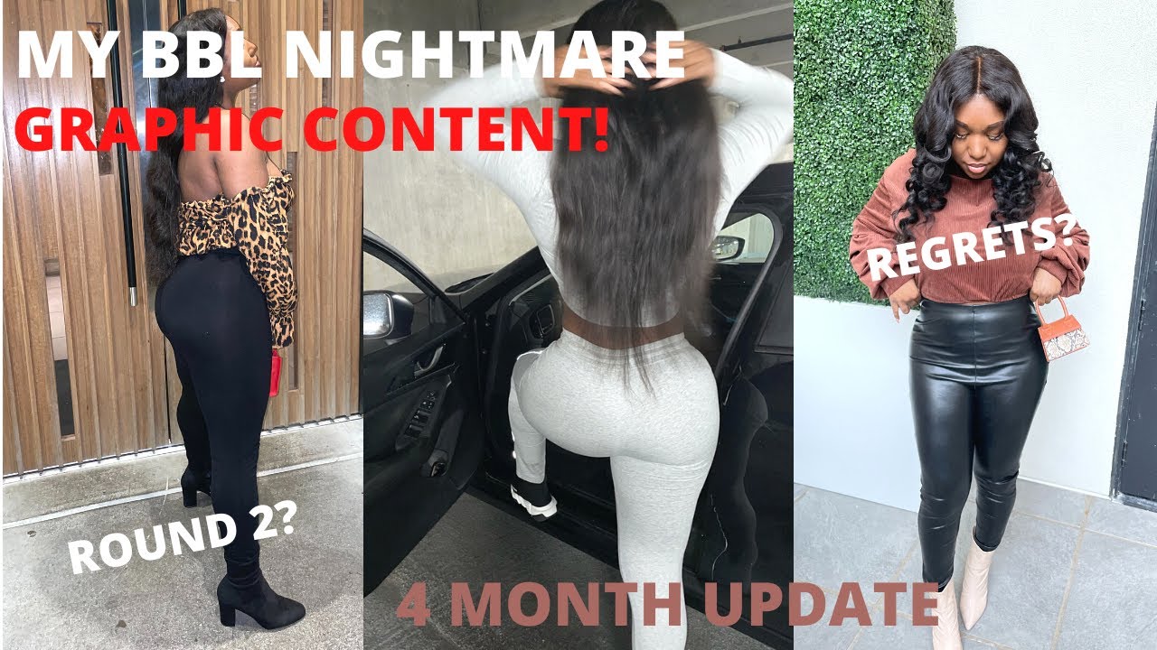 goals plastic surgery