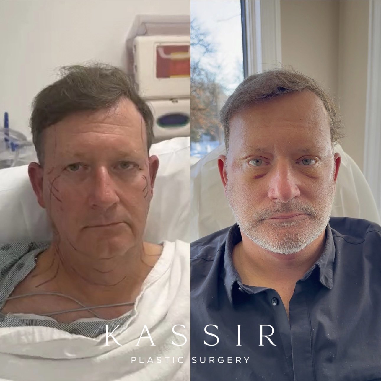 good plastic surgery good plastic surgery