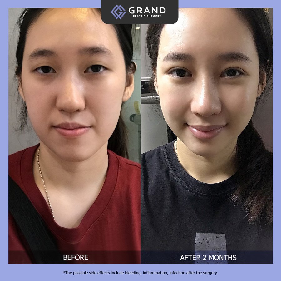 grand plastic surgery