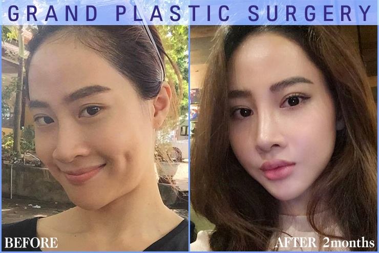 Grand Plastic Surgery: Transformative treatments and care