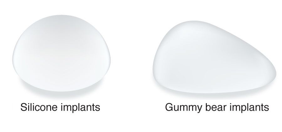 gummy bear implants cost