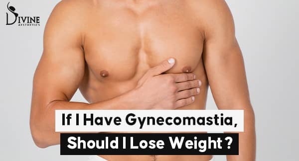 gynecomastia weight loss