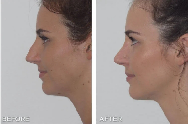 face symmetry surgery