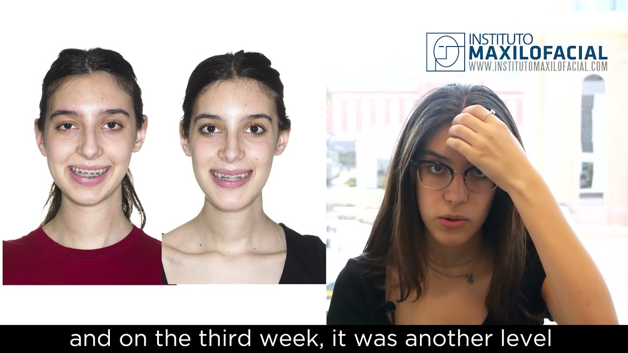 face symmetry surgery