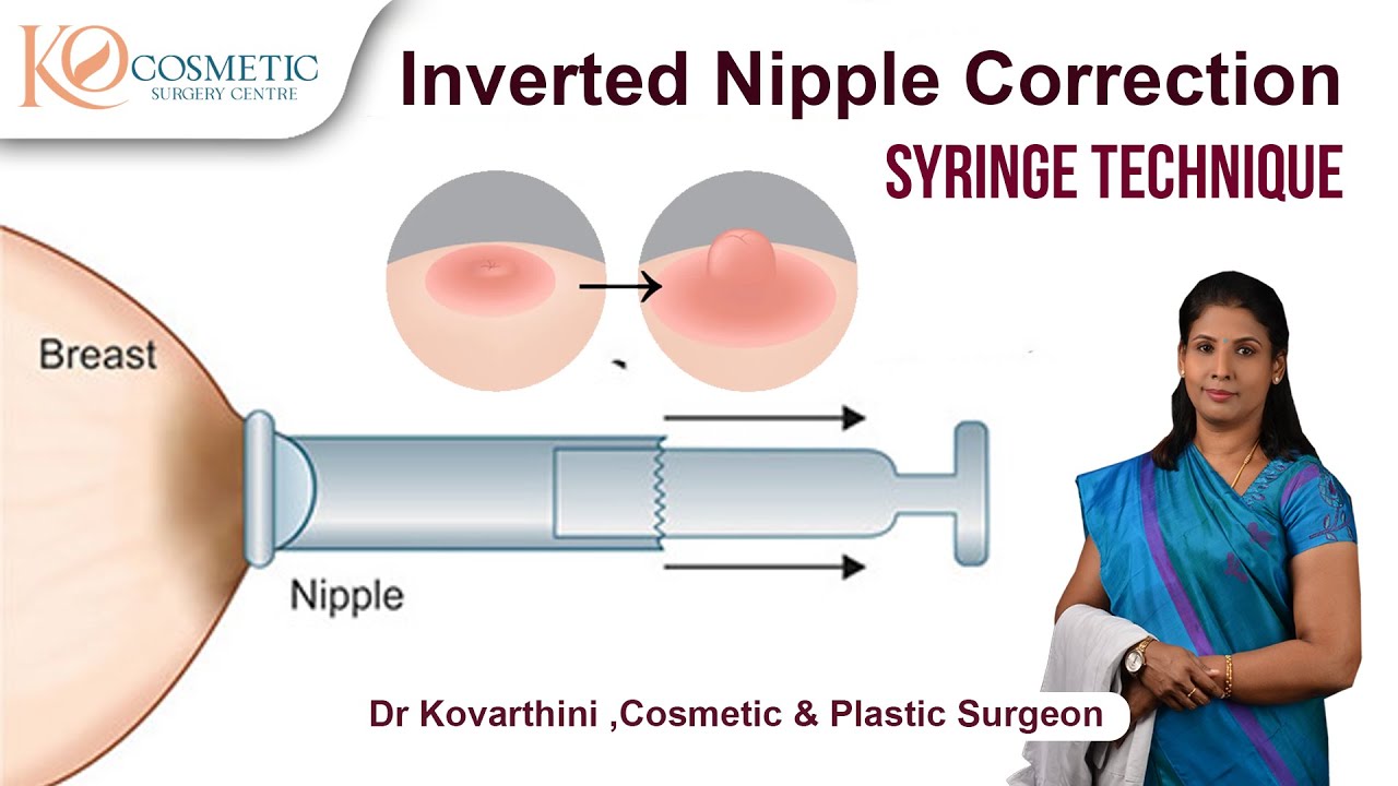 inverted nipple correction