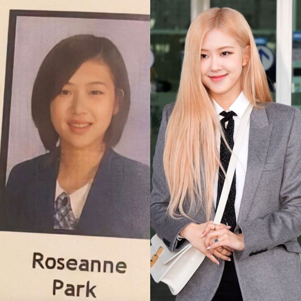 rosé plastic surgery rosé plastic surgery