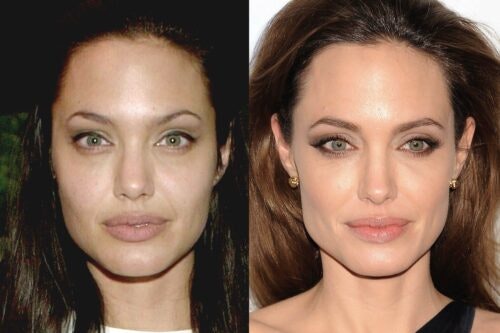 jolie plastic surgery jolie plastic surgery