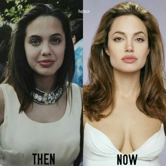 Jolie Plastic Surgery: Expertise in aesthetic transformations