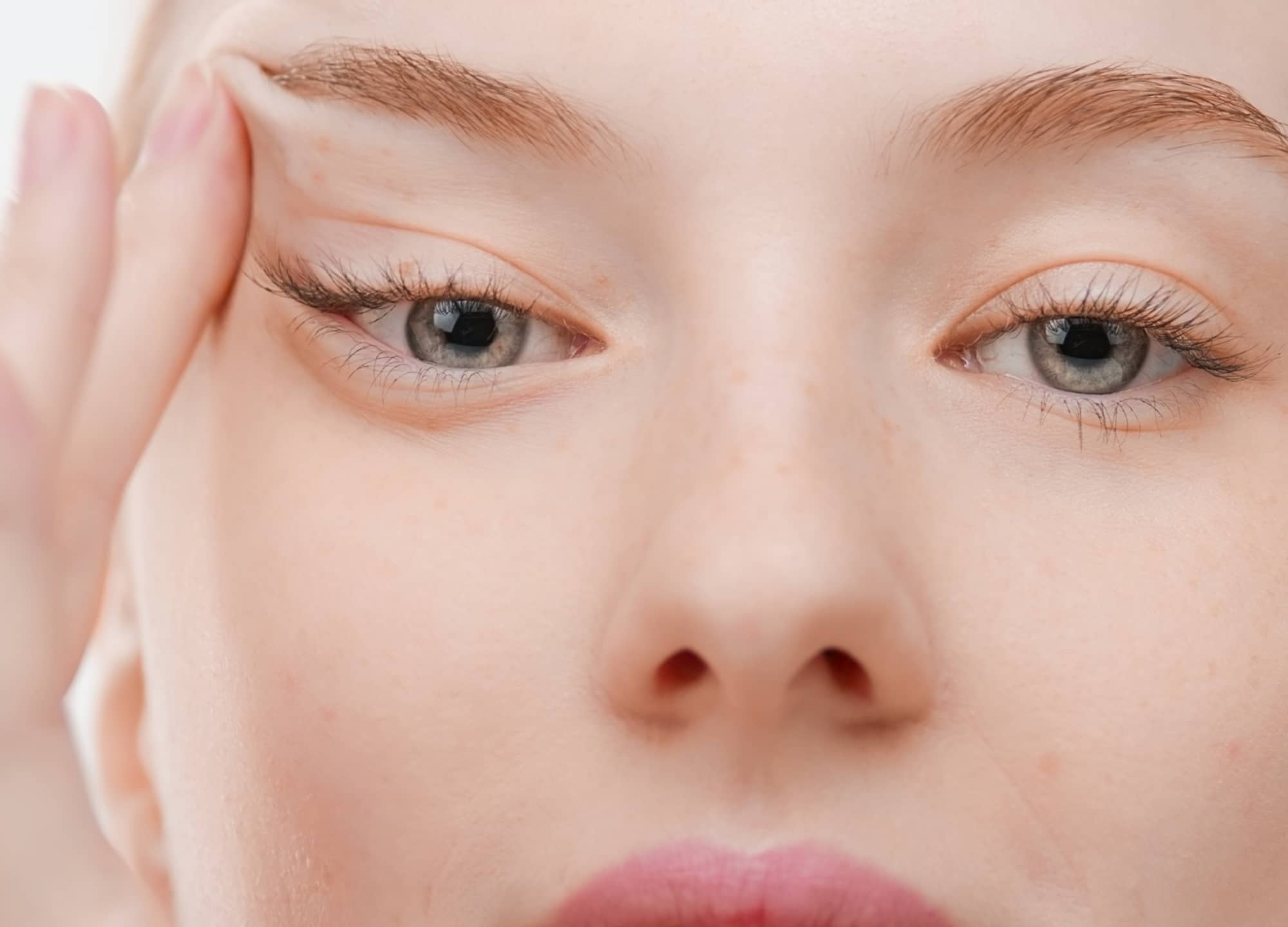 lateral brow lift
